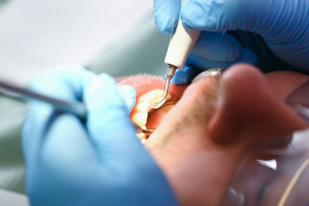 Best Teeth Whitening  in Woodlawn Beach, FL